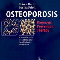 Osteoporosis: Diagnosis- Prevention- Therapy Edition-1st by Reiner Bartl