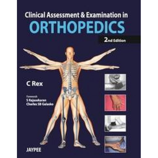 Clinical Assessment and Examination in Orthopedics 2nd Edition by C Rex