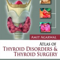 Atlas of Thyroid Disorders and Thyroid Surgery by Amit Agarwal