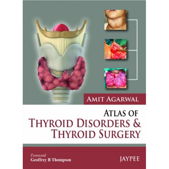 Atlas of Thyroid Disorders and Thyroid Surgery by Amit Agarwal