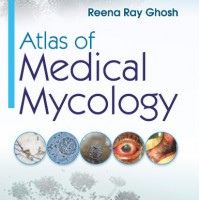Atlas of Medical Mycology by Reena Ray Ghosh