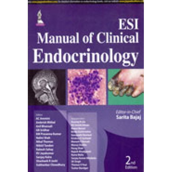 ESI Manual of Clinical Endocrinology 2nd Edition by Sarita Bajaj