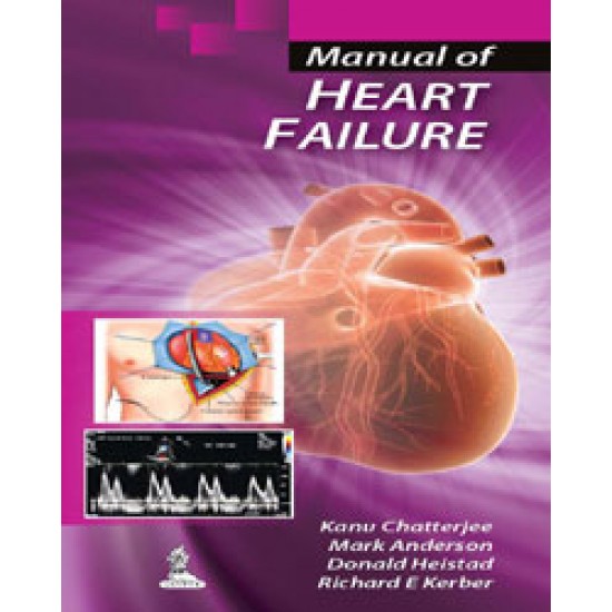 Manual of Heart Failure by Kanu Chatterjee