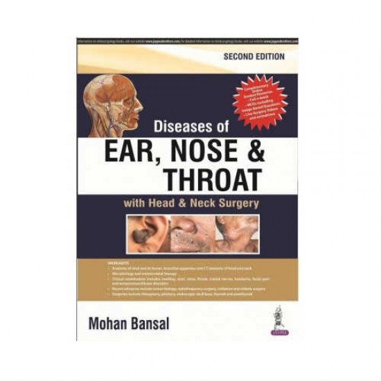 Diseases Of Ear,Nose & Throat 2nd Edition by Mohan Bansal