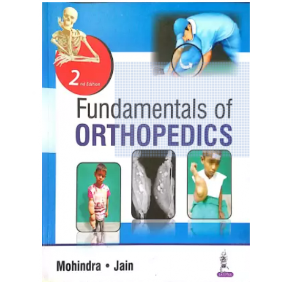 Fundamentals of Orthopedics 2nd Edition by Mohindra Mukul