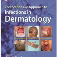 Comprehensive Approach to Infections in Dermatology by Singal Archana