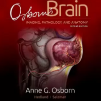 Osbors Brain 2nd Edition by Osborn Anne G. MD, FACR