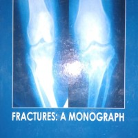 Fractures a monograph by Dr. Murali Produval