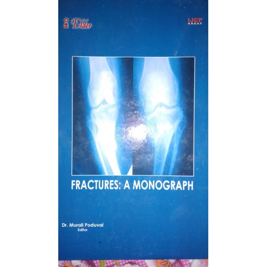 Fractures a monograph by Dr. Murali Produval