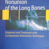 Nonunion Of The Long Bones by R. Mora