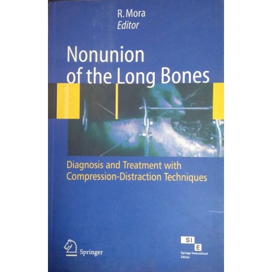 Nonunion Of The Long Bones by R. Mora