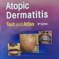 Atopic Dermatitis Text and Atlas 2nd Edition by Rashmi Sarkar