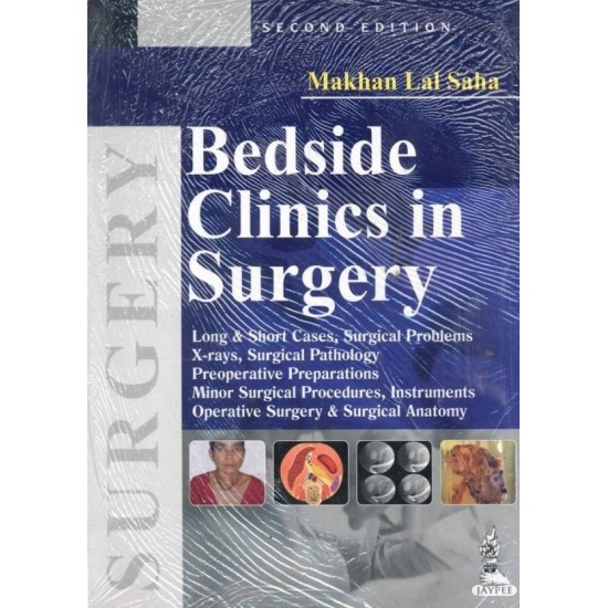 BEDSIDE CLINICS IN SURGERY 2nd Edition by MAKHAN LAL SAHA