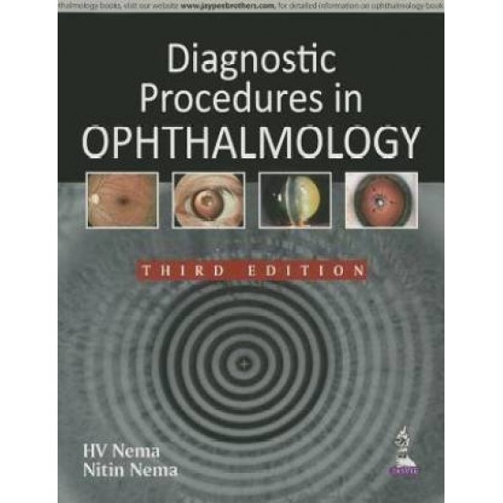 Diagnostic Procedures in Ophthalmology by  Nema HV