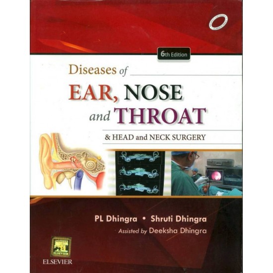 Diseases of Ear , Nose and Throat 6th Edition by PL Dhingra 