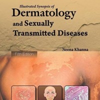 Illustrated Synopsis of Dermatology & Sexually Transmitted Diseases by Khanna Neena