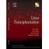 Liver Transplantation by As Soin Ecab Clinical Update Surgical Gastroenterology