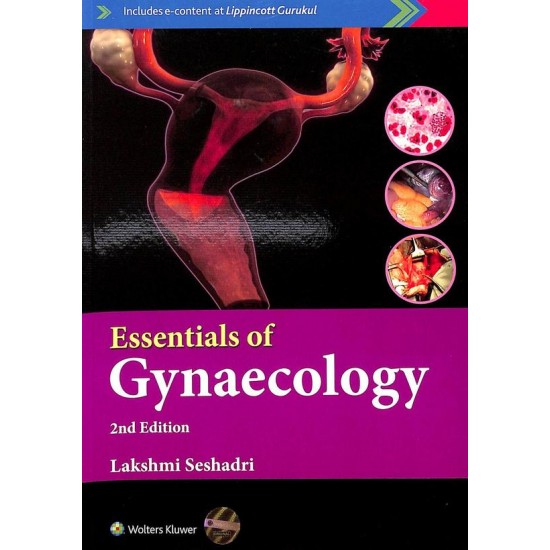 Essentials Of Gynaecology 2nd Edition by Lakshmi Seshadri