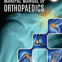 Manipal Manual Of Orthopaedics by Vivek Pandey