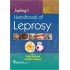 Joplings Handbook Of Leprosy 6th Edition by Kabir Sardana, Ananta Khurana
