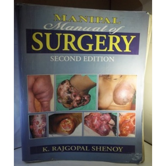 Manipal Manual of Surgery by K. Rajgopal Shenoy 