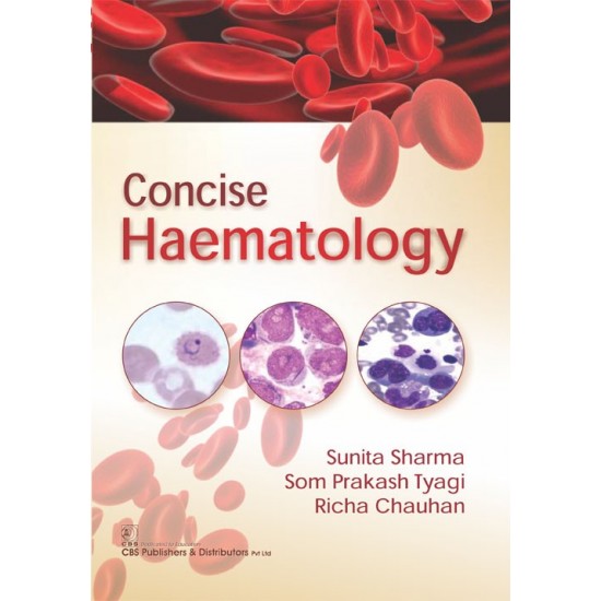 Concise Haematology by Sunita Sharma